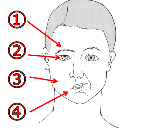 第52回 H29 理学療法士国家試験 解説 午前問題16 明日へブログ